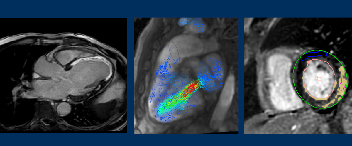 Cardiac MRI @ Noble imaging and diagnostics.