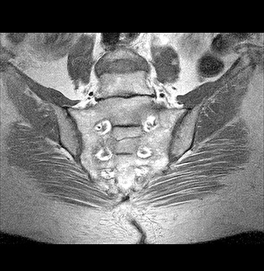 MRI Joints