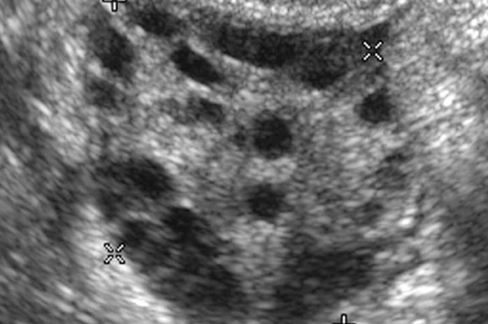 Fertility is a multifaceted domain, and understanding one’s reproductive potential is essential, especially when planning for pregnancy. Among the various fertility tests,