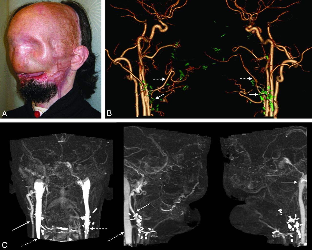 CT Angiography and Perfusion Studies of Head / Neck / Body / Extremities