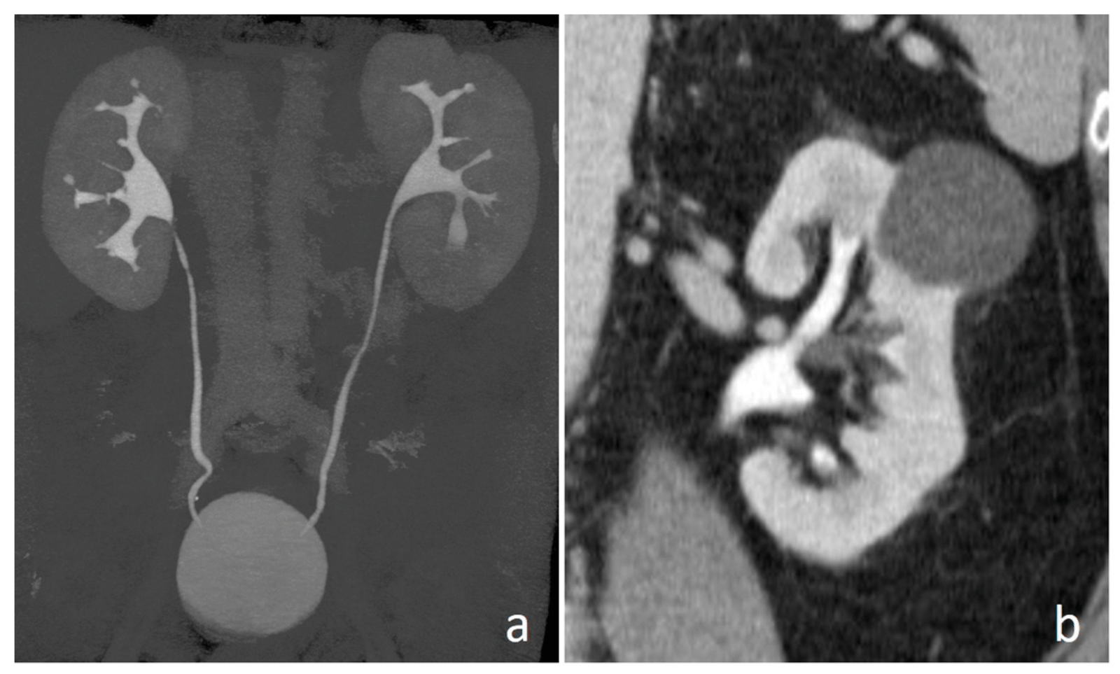CT Urography / Dual / Triple phase Organ Imaging