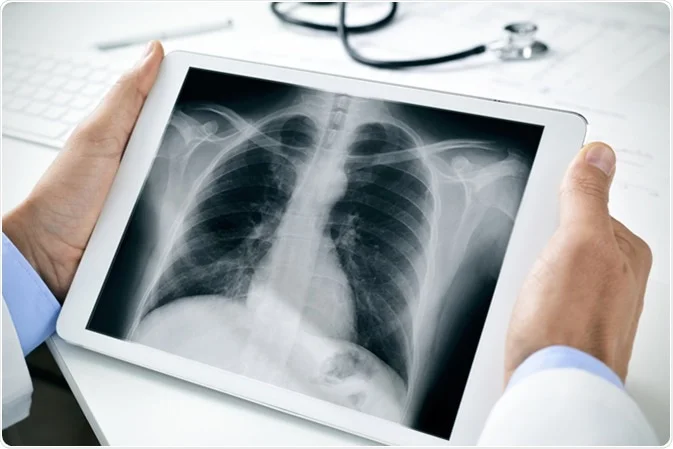 Digital X-Ray In Nagpur
