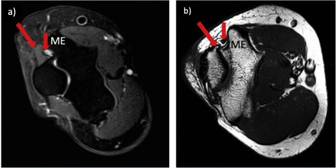Muscooskeletal & Neurosonography