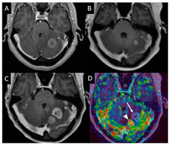 Oncology and Cancer Imaging