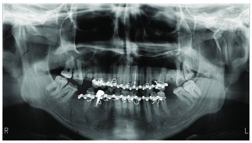 Panoramic Organ Imaging