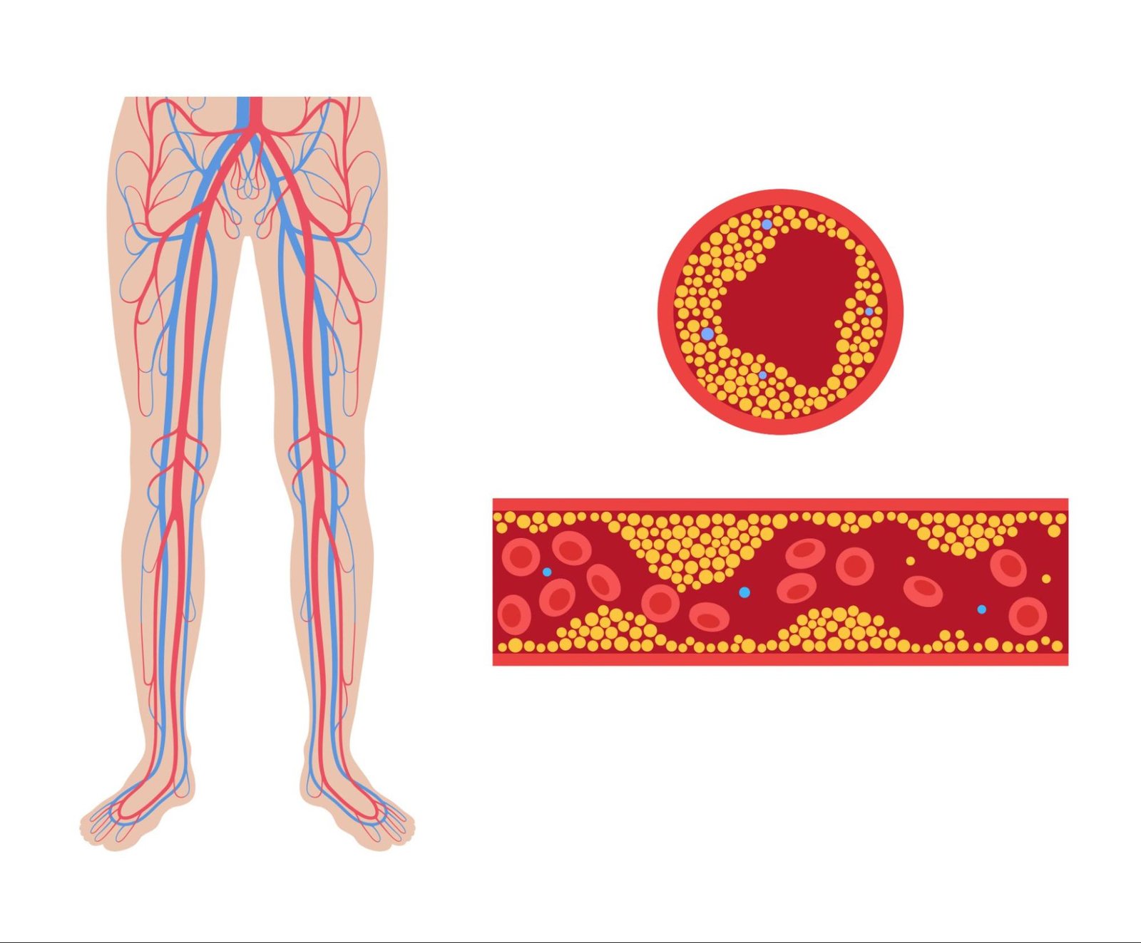 Peripheral Arterial & Venous