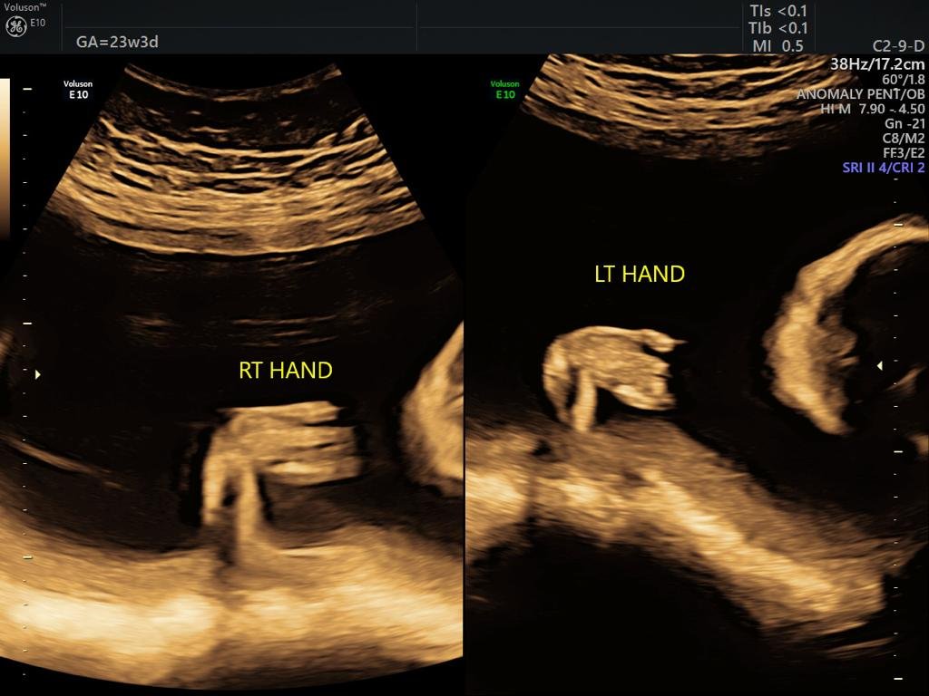 Targetted Obstetric Imaging