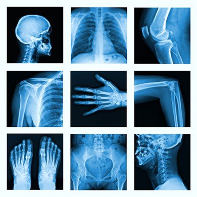X-ray is an advanced imaging technique that uses electronic sensors instead of traditional film to capture images of the body.